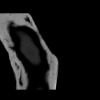 SPORK, NICO - 22.03.1976 - 02.08.2022 - CT obere Extremität - 18:01:46